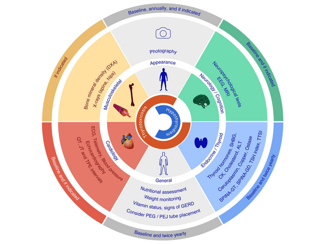 Circular infographic showing the recommended assessments for Allan-Herndon-Dudley syndrome. It includes general, neurological, neuropsychological, endocrine, cardiac and musculoskeletal evaluations, together with the recommended assessment intervals.