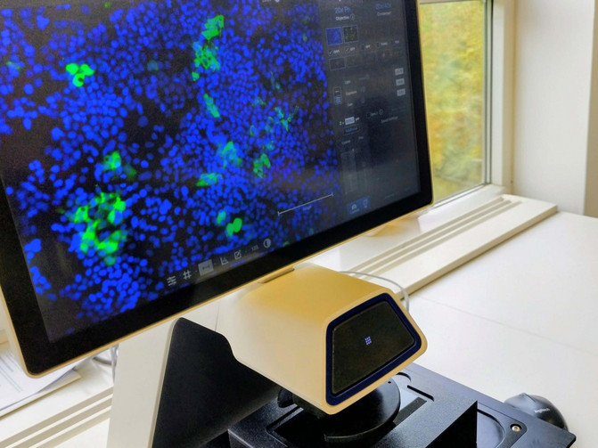 Man sieht den Replikationsvirus des Hepatitis E Virus auf einem Computer